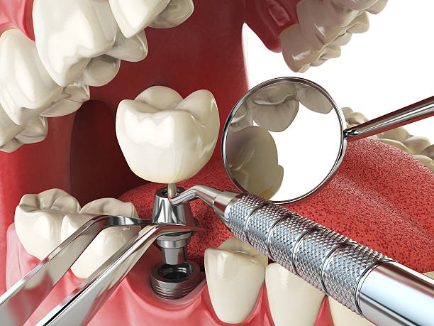 Best Mobile Emergency Dentist in Winthrop, IA